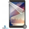 Screenshield iget Smart G102 fólie na displej IGT-SMTG102-D