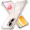 Techsuit – Shockproof Clear Silicone puzdro pre Honor 400 – priehľadné KF2349872