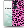 Picasee silikónový prehľadný obal pre Honor 70 - Pink Tiger