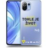Picasee silikónový prehľadný obal pre Xiaomi Mi 11 Lite - Kazma - TOHLE JE ŽIVOT A NIC VÍC NEBUDE