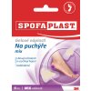 3M™ SPOFAPLAST 913 Gélové náplasti na pľuzgiere mix 5 ks
