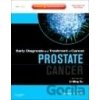 Prostate Cancer - Li-Ming Su