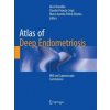 Atlas of Deep Endometriosis (Alice Brandão,Claudio Peixoto Crispi,Marco Aurelio Pinho Oliveira)(Brožovaná)
