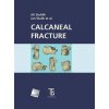 Calcaneal fracture - Jiří Stehlík, Jan Štulík