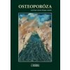 osteoporoza, osteoporoza payer, osteoporóza, payer