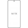 engaroGuard Hydrogel - ochranná fólia - Xiaomi Mi 11X priesvitná nepoužívam kryt = fólia na celý displej 1 kus s výrezom prednej kamery
