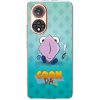 Picasee silikónový prehľadný obal pre Huawei Nova 9 - COONDA holátko - světlá