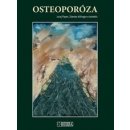 Osteoporóza - Juraj Payer, Zdenko Killinger