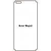engaroGuard Hydrogel - ochranná fólia - Huawei Honor Magic3 priesvitná nepoužívam kryt = fólia na celý displej 1 kus s výrezom prednej kamery