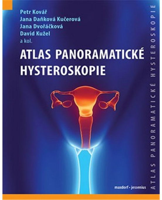 Atlas panoramatické hysteroskopie