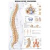 Human Spine Disorders Anatomical Chart