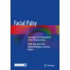Facial Palsy