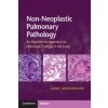 Non-Neoplastic Pulmonary Pathology with Online Resource (Sanjay Mukhopadhyay)(Pevná)