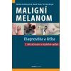 Maligní melanom - Diagnostika a léčba, Arenbergerová Monika, 2024