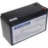 AVACOM RBC2