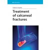 Treatment of calcaneal fractures Vladimír Popelka 2018 (E-kniha)