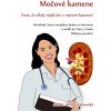 Močové kamene