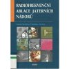Radiofrekvenční ablace jaterních nádorů - Tomáš Skalický, Vladislav Třeška