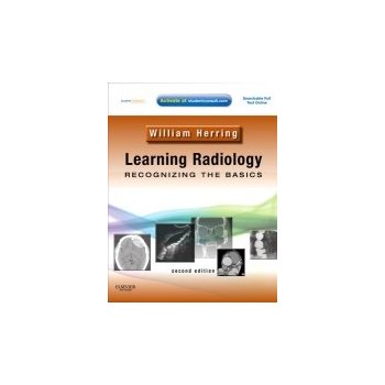 Learning Radiology: Recognizing the Basics