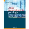 Atlas makroskopické patologie (Jaroslav Horáček, kolektív)
