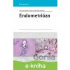 E-kniha Endometrióza - Jiří Lenz, Radek Chvátal, Luděk Fiala