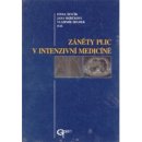Záněty plic v intenzivní medicíně - Pavel Ševčík, Jana Skřičková, Vladimír Šrámek et al.