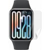 Screenshield XIAOMI Smart Band 9 Pro XIA-SMBND9PR-D