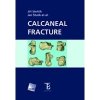 Calcaneal Fracture - Stehlík Jiří