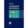 ZLOMENINY PATNÍ KOSTI