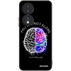 Picasee ULTIMATE CASE pro Honor 70 - Brain - White