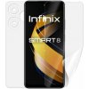 Screenshield INFINIX Smart 8 fólia na celé telo INF-SM8-B