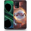Picasee silikónový prehľadný obal pre Realme 8 5G - Nebula