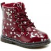 Wojtylko 1Z23007 červené detské zimné topánky - EU 23