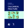 Calcaneal fracture - Jiří Stehlík, Jan Štulík, et al.
