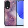 VSETKONAMOBIL 48561 MY ART Silikónový obal Honor 50 / Huawei Nova 9 -PURPLE (148)