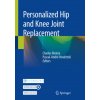 Personalized Hip and Knee Joint Replacement