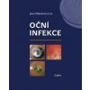 Oční infekce - Jana Nekolová