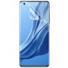 Ochranná fólia Baseus pre Xiaomi Mi 11, 2 ks