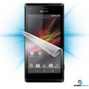 Ochranná fólia Screenshield Sony Xperia M - displej