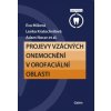 Projevy vzácných onemocnění v orofaciální oblasti - Lenka Kratochvílová