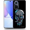 Picasee ULTIMATE CASE pro Huawei Nova 9 - EARTH - Lebka 3.0