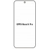 engaroGuard Hydrogel - ochranná fólia - OPPO Reno 14 Pro 5G priesvitná nepoužívam kryt = fólia na celý displej 1 kus s výrezom prednej kamery