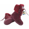 Zimná detská obuv Protetika Kaja Bordo - veľ. 33