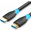 Video kábel Vention HDMI 1.4 Exclusive Cable 15m Black Type (AAGBN)