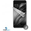 Screenshield™ XIAOMI Mi 6 Global fólia na displej