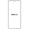 Hydrogel - ochranná fólia - Huawei Honor X7a (case friendly)