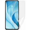 Ochranná fólia Screenshield Anti-Bacteria XIAOMI 11 Lite 5G NIE na displej (XIA-11LT5GNEAB-D)