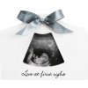 Happy Hands sonogram Echo Frame