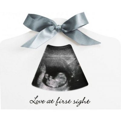 Happy Hands sonogram Echo Frame