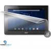 Screenshield™ Acer ICONIA TAB 10 A3-A30